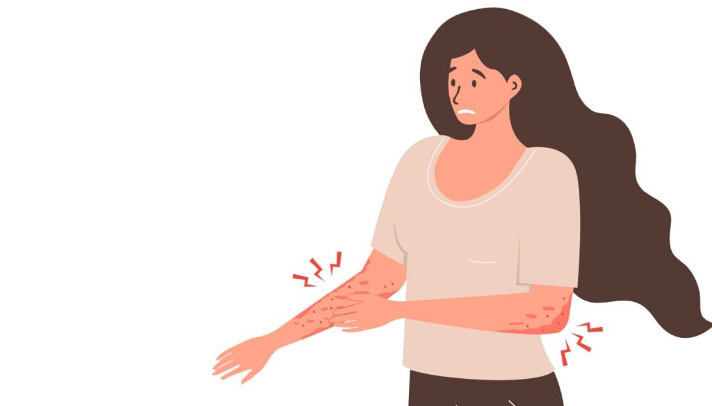 Homeopatia para Problemas de Pele